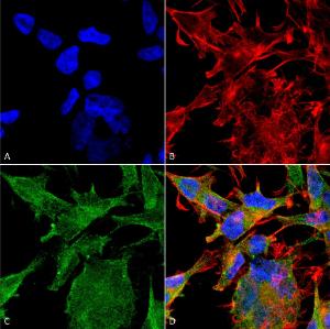 Immunocytochemistry/Immunofluorescence analysis of human neuroblastoma cell line (SK-N-BE, fixed in 4% formaldehyde for 15 min at room temperature, using Anti-VAChT Antibody [S6-38] (A305008), at 1:100 for 60 minutes at room temperatur