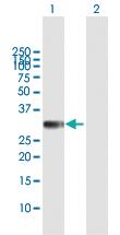 Anti-HS2ST1 Mouse Polyclonal Antibody