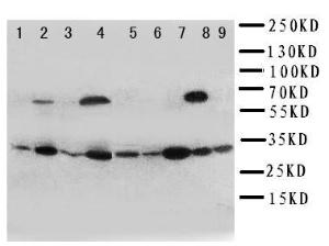 Anti-Kallikrein 10 Rabbit Polyclonal Antibody