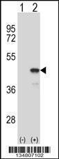 Anti-MAP2K1 Rabbit Polyclonal Antibody (APC (Allophycocyanin))