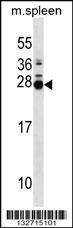 Anti-MOL2B Rabbit Polyclonal Antibody (HRP (Horseradish Peroxidase))