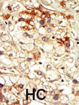 Anti-CDK17 Rabbit Polyclonal Antibody (PE (Phycoerythrin))