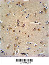 Anti-GABRG3 Rabbit Polyclonal Antibody (HRP (Horseradish Peroxidase))