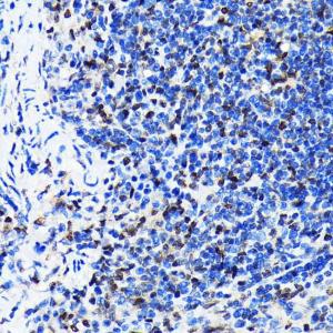 Immunohistochemistry analysis of paraffin-embedded mouse spleen using Anti-HuR / ELAVL1 Antibody [ARC0101] (A307808) at a dilution of 1:100 (40x lens). Perform microwave antigen retrieval with 10 mM PBS buffer pH 7.2 before commencing with IHC staining protocol.