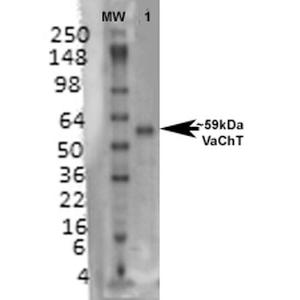 Western blot analysis of rat brain membrane lysate showing detection of VAChT protein using Anti-VAChT Antibody [S6-38] (A305008) at 1:1,000