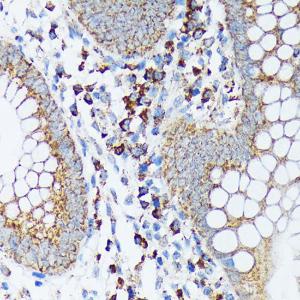 Immunohistochemistry analysis of paraffin-embedded human appendix tissue using Anti-Spry-2 Antibody [ARC1753] (A306129) at a dilution of 1:100 (40X lens). Perform microwave antigen retrieval with 10 mM Tris/EDTA buffer pH 9.0 before commencing with IHC staining protocol