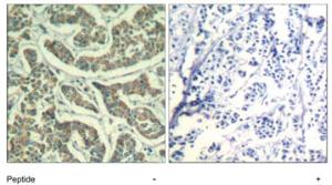 Anti-ATR Rabbit Polyclonal Antibody