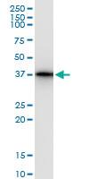 Anti-LZTFL1 Polyclonal Antibody Pair