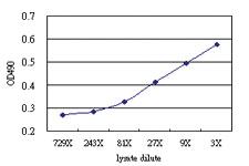 Anti-PRLR Antibody Pair