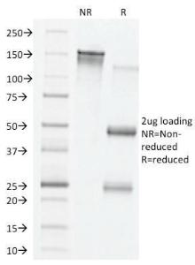 SDS-PAGE analysis of Anti-VEGF Antibody [VG76e] under non-reduced and reduced conditions; showing intact IgG and intact heavy and light chains, respectively. SDS-PAGE analysis confirms the integrity and purity of the antibody.