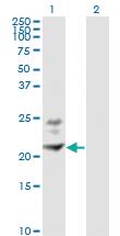 Anti-BST2 Mouse Monoclonal Antibody [clone: 3H4]