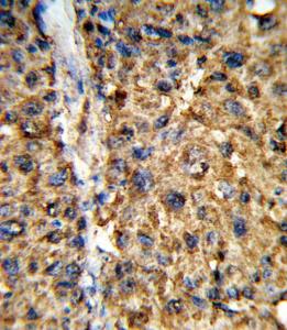 Anti-GSTA2 Rabbit Polyclonal Antibody (APC (Allophycocyanin))