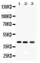 Anti-RAGE Rabbit Polyclonal Antibody