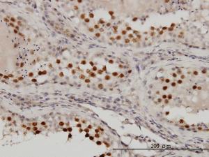 Anti-RACGAP1 Mouse Monoclonal Antibody [clone: 1G6]