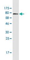 Anti-CK6B Mouse Monoclonal Antibody [clone: 1C4]