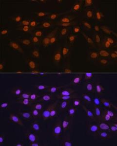 Immunofluorescence analysis of C6 cells using Anti-HuR / ELAVL1 Antibody [ARC0101] (A307808). DAPI was used to stain the cell nuclei (blue).