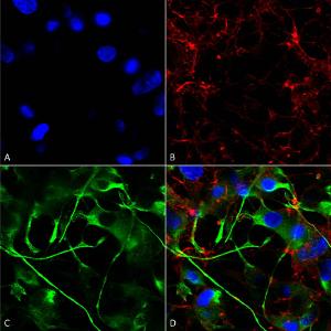 Immunocytochemistry/Immunofluorescence analysis of human neuroblastoma cells (SH-SY5Y), fixed in 4% PFA for 15 min, using Anti-VAChT Antibody [S6-38] (A305008), at 1:200 for overnight at 4°C with slow rockin