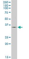 Anti-TPSAB1 Rabbit Polyclonal Antibody