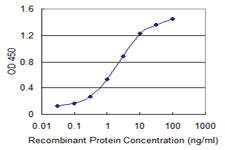 Anti-ILKAP Mouse Monoclonal Antibody [clone: 3B5]