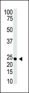 Anti-NEUROG3 Rabbit Polyclonal Antibody (Biotin)