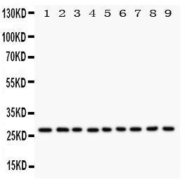 Anti-Kallikrein 6 Rabbit Polyclonal Antibody