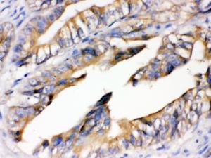 Anti-RAGE Rabbit Polyclonal Antibody