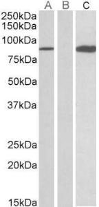 HEK293 lysate (10ug protein in RIPA buffer) overexpressing Human STAT4 (RC206892) with C-terminal MYC tag probed