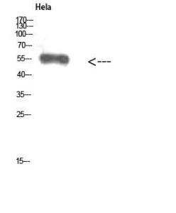 Western blot analysis of Hela cells using Anti-VIM Antibody