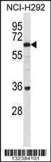 Anti-BTBDG Rabbit Polyclonal Antibody