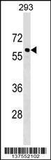 Anti-CACNB3 Rabbit Polyclonal Antibody (FITC (Fluorescein Isothiocyanate))