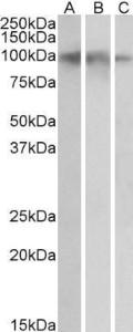 Anti-NTRK2 Antibody (A83183) (0.05 µg/ml) staining of Human Hippocampus (A), Cerebral Cortex (B) and Cerebellum (C) lysates (35 µg protein in RIPA buffer). Primary incubation was 1 hour. Detected by chemiluminescence