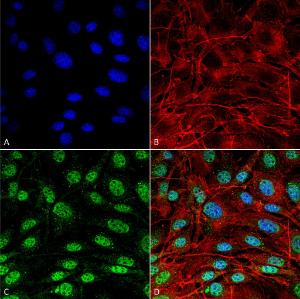 Immunocytochemistry/Immunofluorescence analysis of mouse NIH 3T3 (mouse fibroblast cell line), fixed in 4% formaldehyde for 15 min at room temperature, using Anti-SQSTM1/p62 Antibody (A305009), at 1:100 for 60 minutes at room temperature