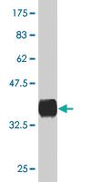 Anti-NPY Mouse Monoclonal Antibody [clone: 3B5]