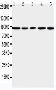 Anti-MCM6 Rabbit Polyclonal Antibody