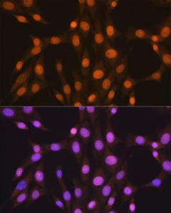 Immunofluorescence analysis of NIH-3T3 cells using Anti-HuR / ELAVL1 Antibody [ARC0101] (A307808). DAPI was used to stain the cell nuclei (blue).