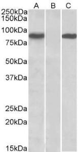 HEK293 lysate (10ug protein in RIPA buffer) overexpressing Human STAT4 (RC206892) with C-terminal MYC tag probed with Anti-STAT4 Antibody (A84780) (1µg/ml) in Lane A and probed with anti-MYC Tag (1/1000) in lane C