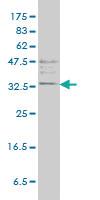 Anti-TPSAB1 Mouse Monoclonal Antibody [clone: 2A10-B5]