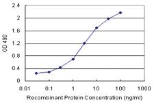 Anti-AHSG Antibody Pair