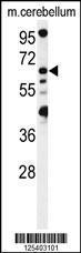 Anti-MON1B Rabbit Polyclonal Antibody (PE (Phycoerythrin))