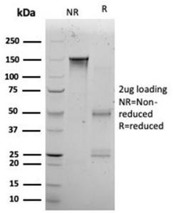 SDS-PAGE analysis of Anti-KLF12 Antibody [PCRP-KLF12-1E3] under non-reduced and reduced conditions; showing intact IgG and intact heavy and light chains, respectively. SDS-PAGE analysis confirms the integrity and purity of the antibody