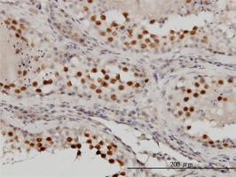 Anti-RACGAP1 Mouse Monoclonal Antibody [clone: 1G6]