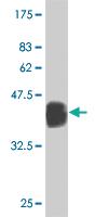 Anti-TRD Mouse Monoclonal Antibody [clone: 2H6]