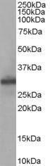 Anti-FHL1 Antibody (A83184) staining (005 µg/ml) of Human Muscle lysate (RIPA buffer, 35 µg total protein per lane) Primary incubated for 1 hour Detected by western blot using chemiluminescence