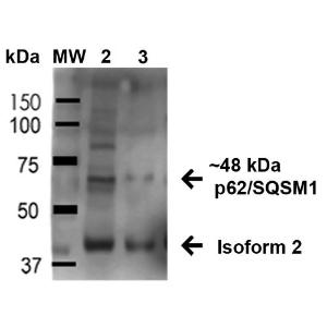 Western blot analysis of human HeLa and HEK293Trap cell lysates showing detection of 47.7 kDa SQSTM1 protein using Anti-SQSTM1/p62 Antibody (A305009) at 1:1,000 for 1 hour at room temperature