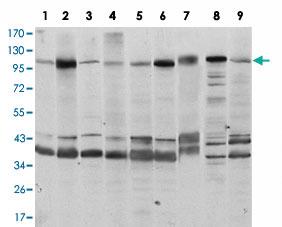 Anti-FUK Mouse Monoclonal Antibody [clone: 6E2]