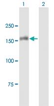 Anti-HDAC6 Mouse Polyclonal Antibody