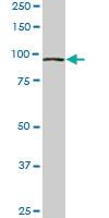 Anti-VPS18 Mouse Monoclonal Antibody [clone: 4F8]