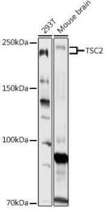 Antibody anti-TSC2 100 µl