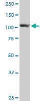 Anti-ADAR Rabbit Polyclonal Antibody