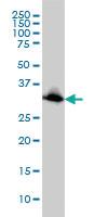 Anti-EMD Mouse Monoclonal Antibody [clone: 3B9]